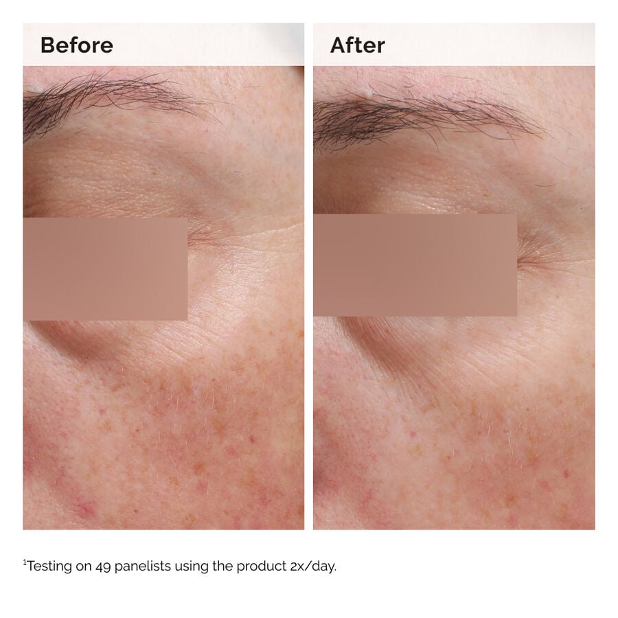niacinamide-5-face-and-body-emulsion-u3 2024-08-23-ORD-Nia-5pct-Face-Body-B-A-Elasticity-Global-02-1x1.jpg
