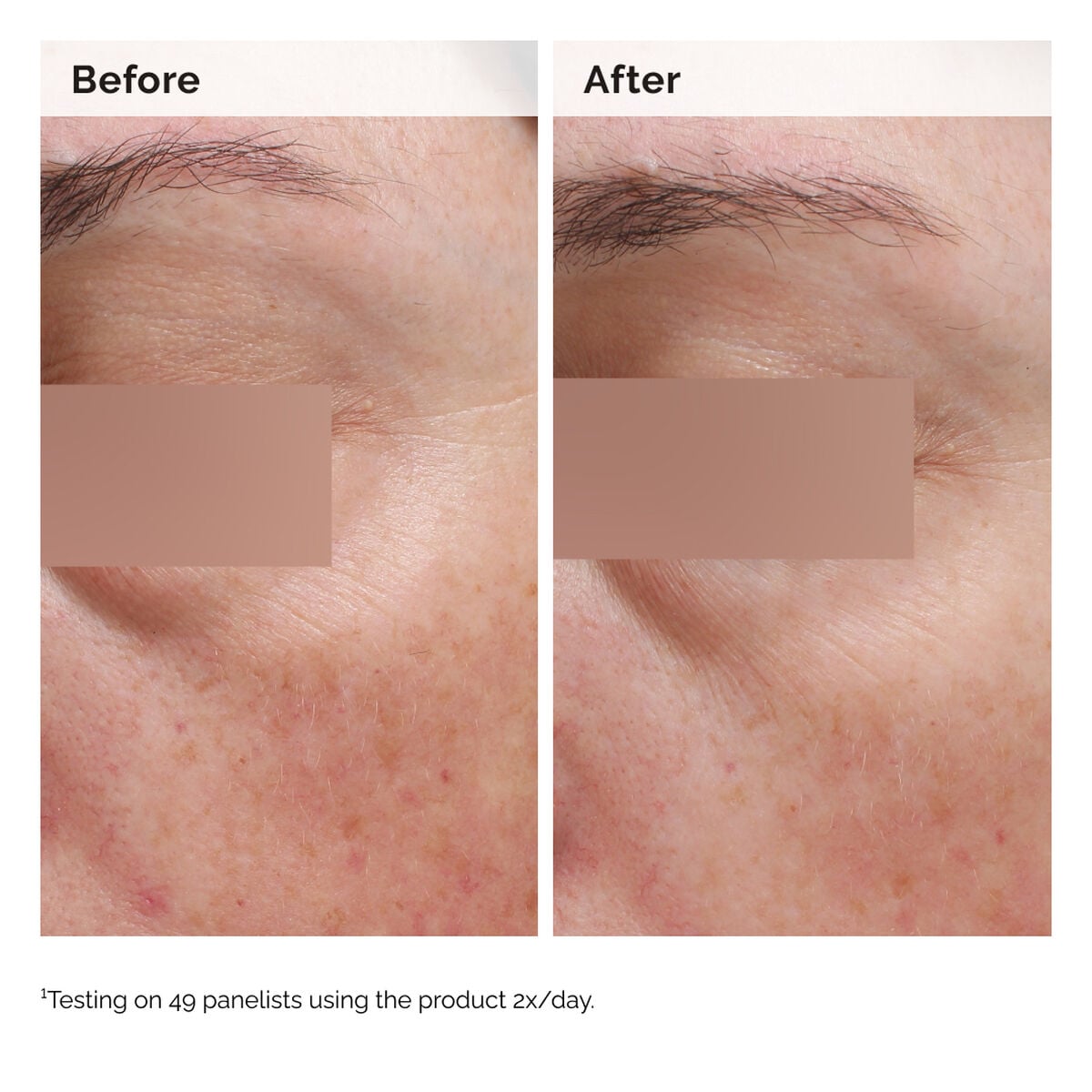 niacinamide-5-face-and-body-emulsion-u3 2024-08-23-ORD-Nia-5pct-Face-Body-B-A-Elasticity-Global-02-1x1.jpg