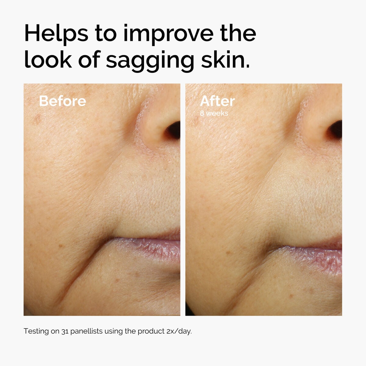 caffeine-3-escin-1-face-serum-u1 ord-caffeine-3pct-escin-1pct-face-serum-before-after-sagging.jpg