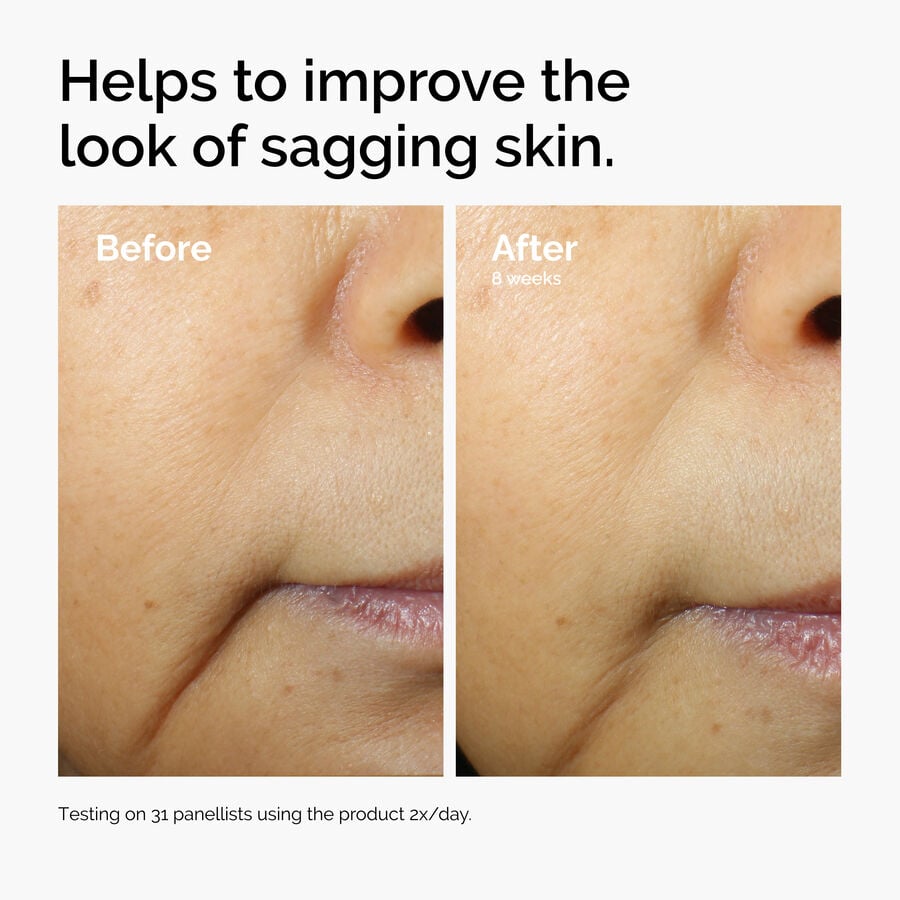 caffeine-3-escin-1-face-serum-u1 ord-caffeine-3pct-escin-1pct-face-serum-before-after-sagging.jpg