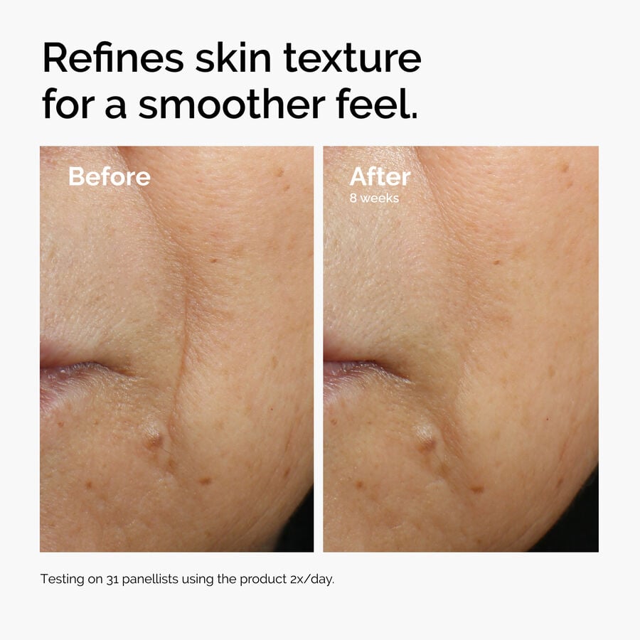caffeine-3-escin-1-face-serum-u1 ord-caffeine-3pct-escin-1pct-face-serum-before-after-texture.jpg