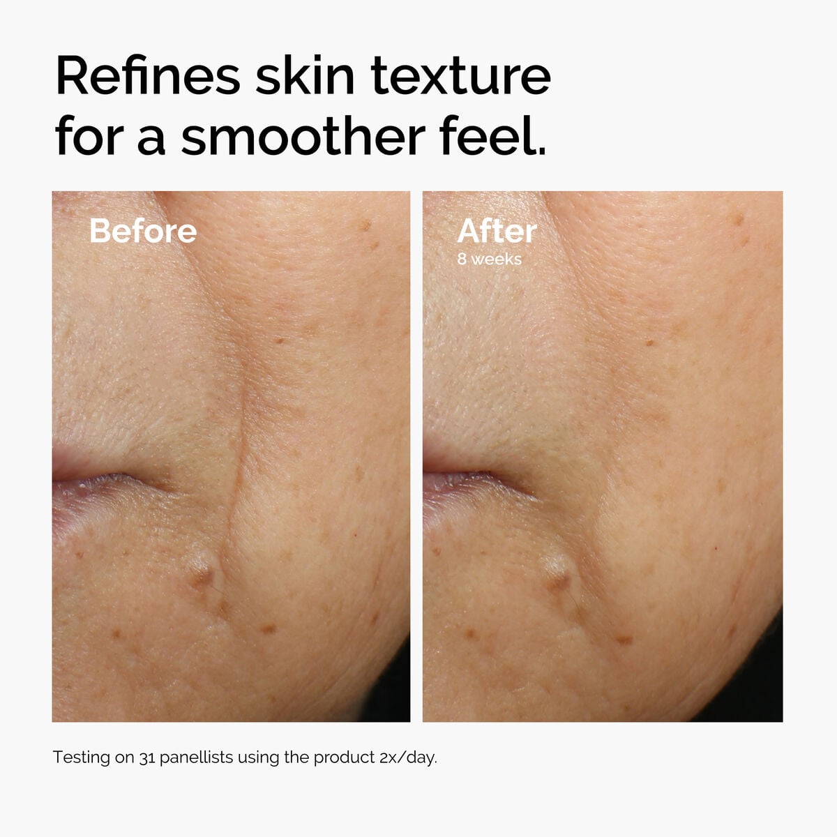 caffeine-3-escin-1-face-serum-u1 ord-caffeine-3pct-escin-1pct-face-serum-before-after-texture.jpg