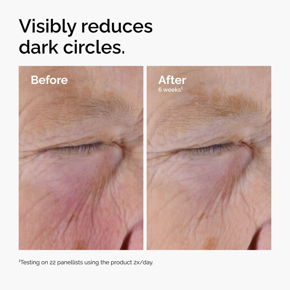 caffeine-solution-5-egcg-eye-serum-g9 ord-caffeine-solution-egcg-dark-circles-before-after.jpg