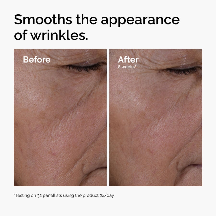 multi-peptide-ha-serum-a5 ord-multi-peptide-ha-serum-wrinkles-before-after.jpg
