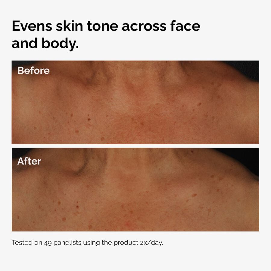 the-body-care-collection-p4 ord-niacinamide-face-body-serum-before-after-even-tone-graphic.jpg