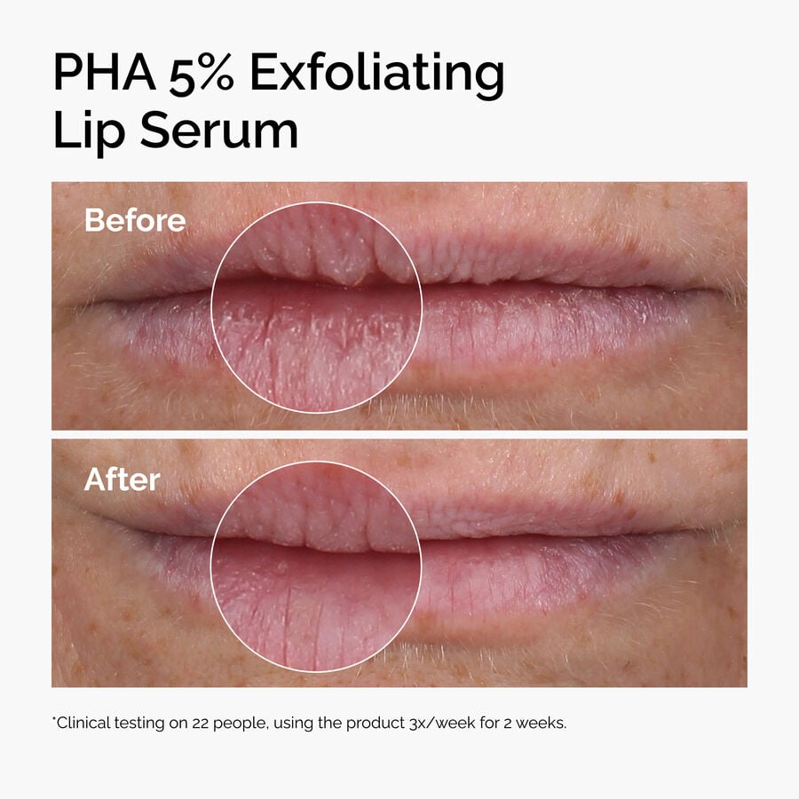 pha-5-exfoliating-lip-serum-u3 ord-pha-5pct-lip-exfoliating-serum-before-after.jpg
