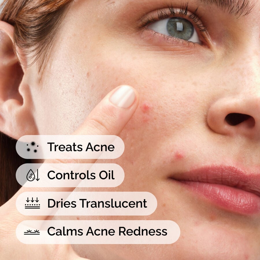 sulfur-10-powder-to-cream-concentrate-w6 ord-sulfur-10pct-powder-to-cream-concentrate-model-application-with-benefits-acne.jpg